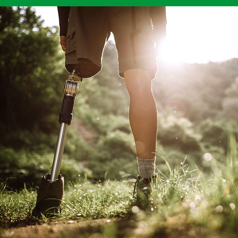 Leistungen Orthopädie Technik