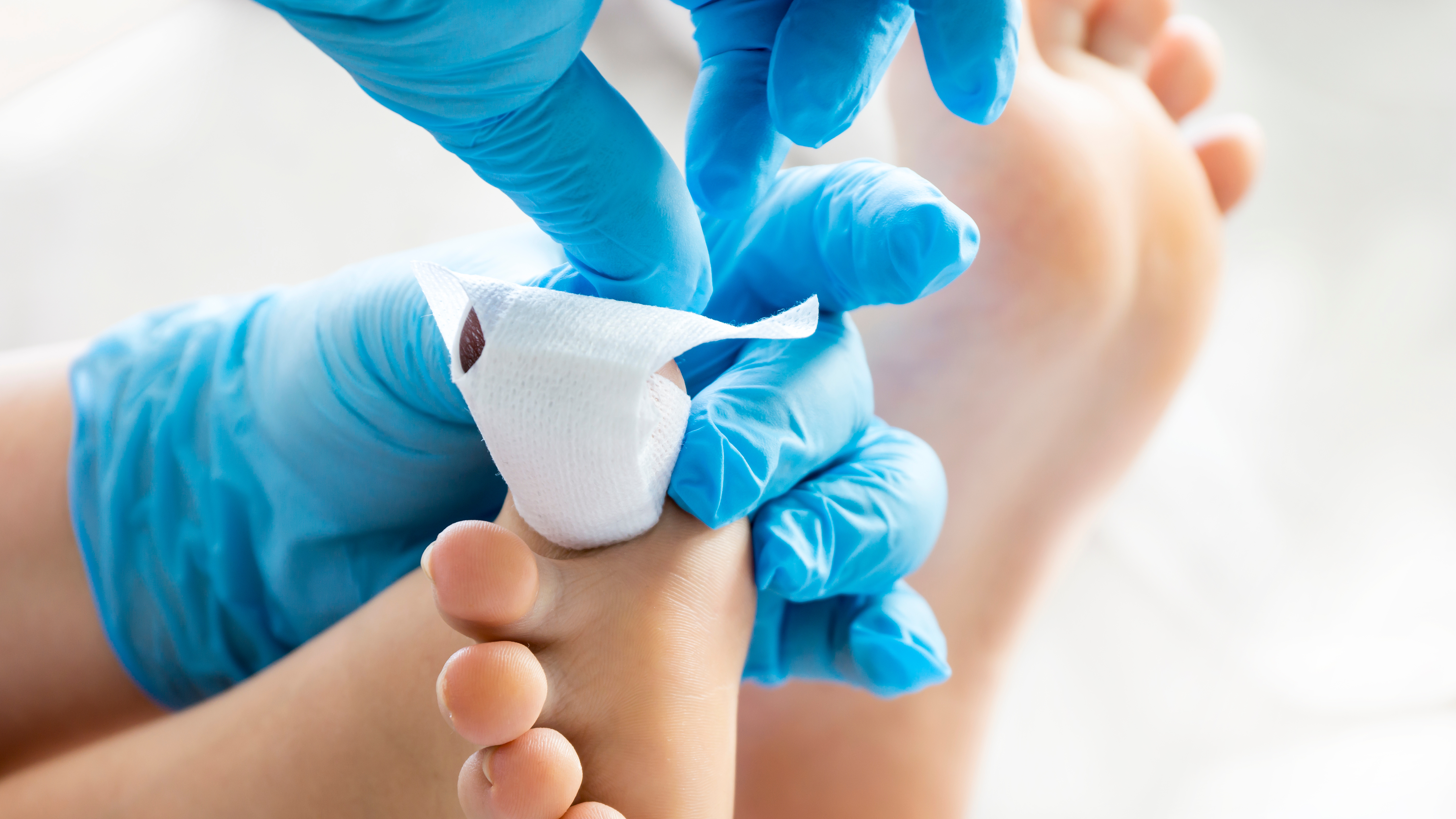 Wundversorgung in der Gefäßchirurgie