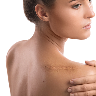 Plastische, Ästhetische & Verbrennungschirurgie